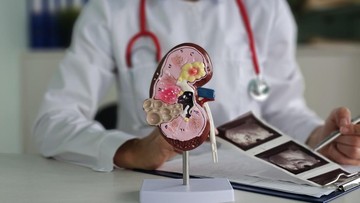 Makanan Sehat untuk Ginjal: Pilihan yang Lezat dan Bergizi