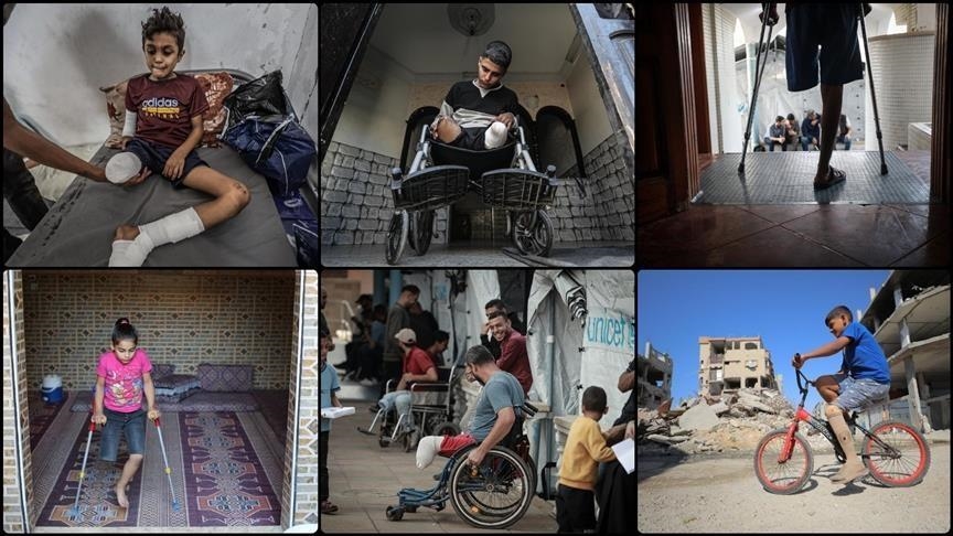 Dukungan Rehabilitasi Vital untuk Penyintas Amputasi di Gaza